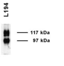 UT2/SLC14A2 Antibody, Novus Biologicals 0.1mL; Unlabeled:Antibodies, Polyclonal